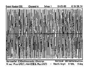 Case Study - Service Area Flicker